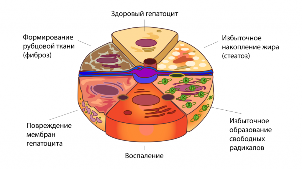 dieta-pri-zabolevaniyakh-pecheni-2.png dieta-pri-zabolevaniyakh-pecheni-2.png